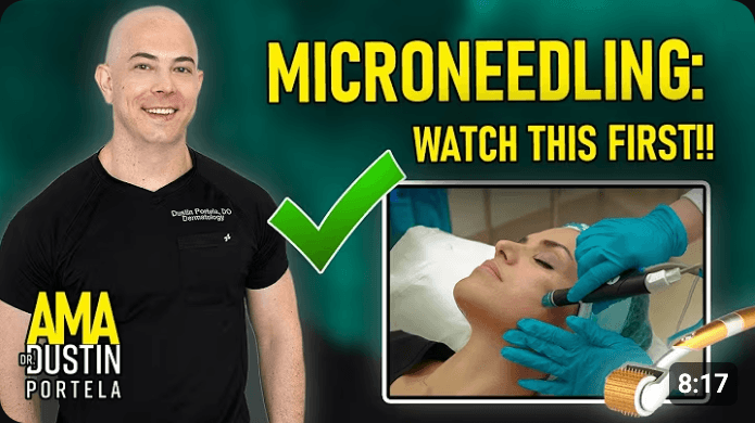 Thumbnail: Microneedling, watch this first